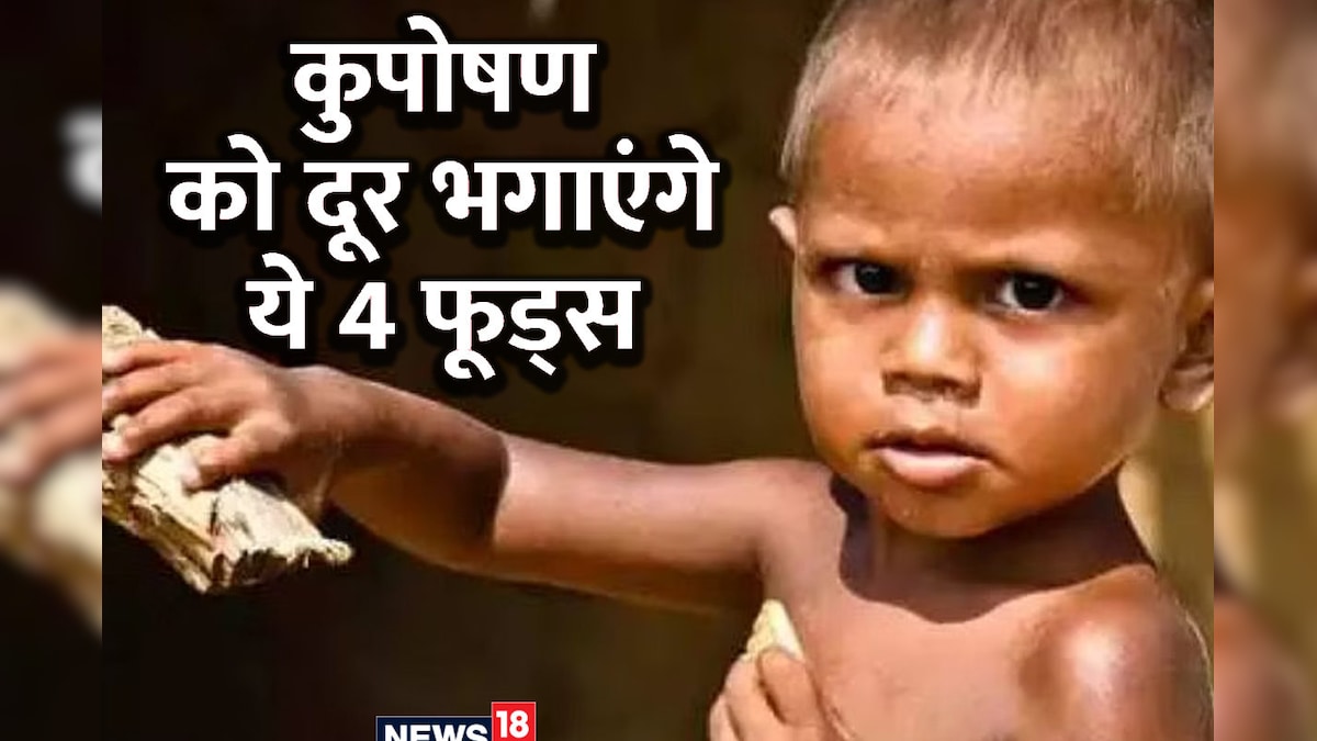 कुपोषण को दूर भगाएंगे ये 4 फूड्स, शरीर को बनाएंगे लोहे सा फौलादी, कमजोरी होगी दूर