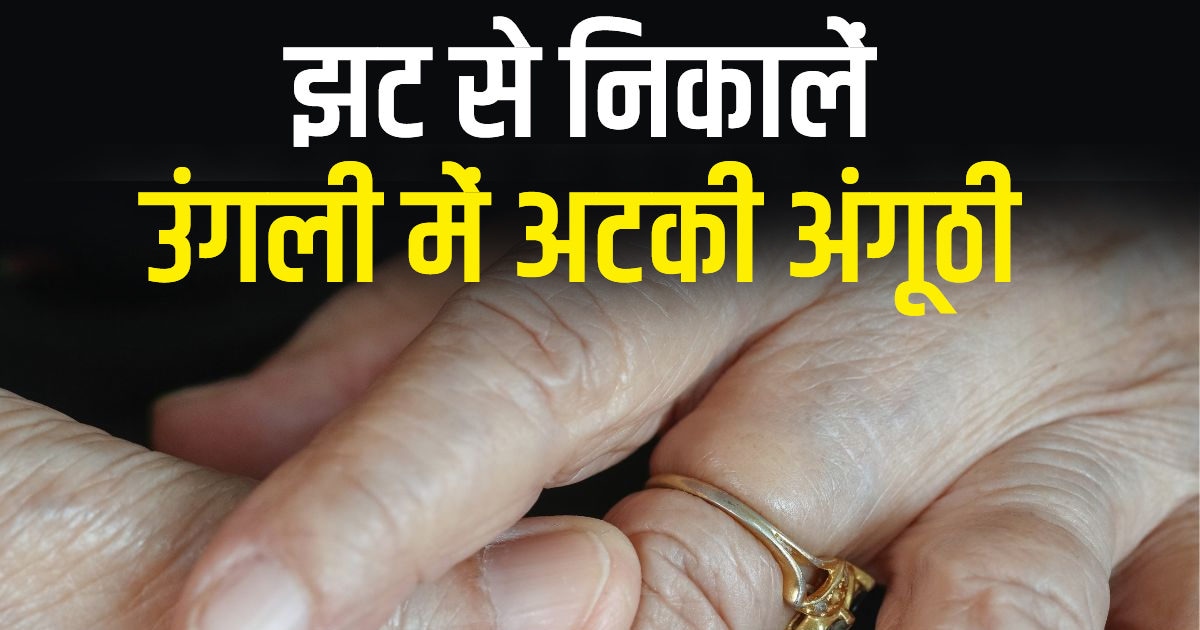 Turtle Ring Jyotish Tips: कछुए वाली अंगूठी होती है बेहद लाभदायक, पहनना है  तो ज़रूर रखें