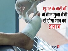 तीन गुना तेजी से ठीक होगा डायबिटीज मरीजों का घाव, वैज्ञानिकों ने निकाला तोड़