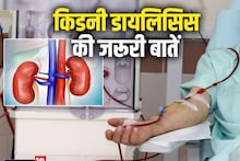 Kidney Dialysis: डायलिसिस के बाद ठीक हो जाती है किडनी? कितने दिन जिंदा रह पाता है मरीज, एम्‍स के प्रोफेसर से जानें