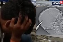 OMG: अपराधियों ने युवक के सिर में घुसा दिया था धारदार सरिया, 3 घंटे की सर्जरी कर डॉक्टरों ने बचाई जान