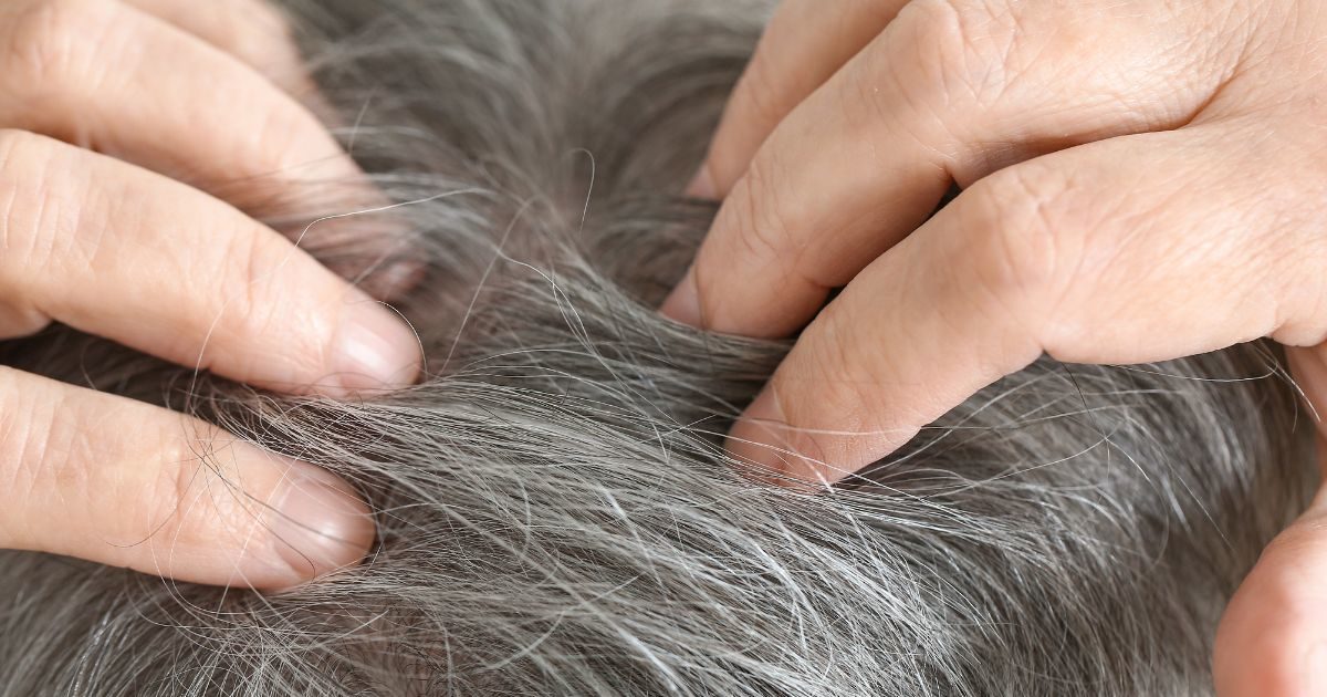 gray hair