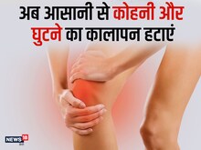 नारियल के तेल में इस चीज को मिलाकर लगाएं, कोहनी और घुटनों का कालापन होगा दूर