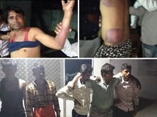 पुलिस पर गंभीर आरोप, सरपंच समेत 4 को पीट-पीटकर किया घायल, ग्रामीणों ने जताया..