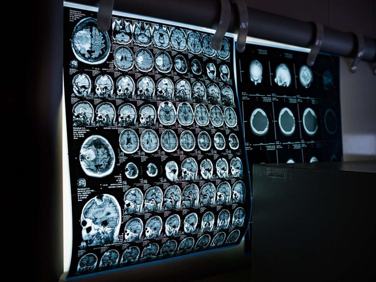 brain at the age of 40, experience change the structure of the brain, structure of the brain, Brain, Brain Power, Human Body Facts, Interesting Facts, Unknown Facts, Human Science, Science News, Science Facts, Research, New Study