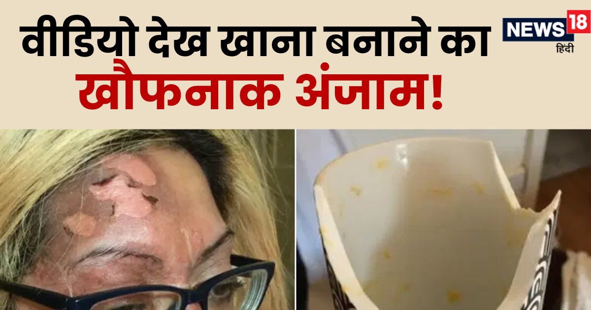 क्या आप भी वीडियो देख बनाते हैं खाना? मोबाइल देखते हुए अंडा पका रही थी ...