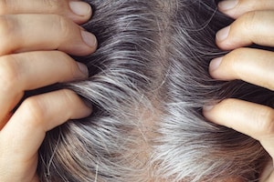 आपके बाल भी हो रहे हैं समय से पहले सफेद, 6 नेचुरल तरीकों का करें इस्तेमाल, कुछ ही दिनों में मिलेगी राहत