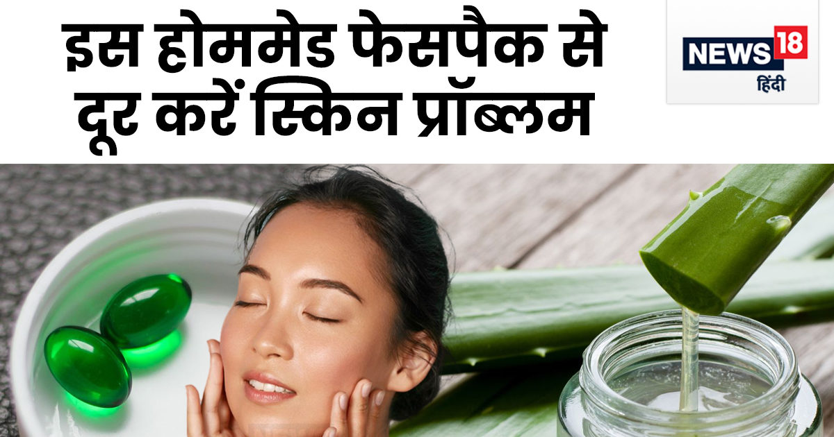 एलोवेरा जेल में मिलाएं हरे रंग का ये कैप्सूल, दूर होगा पिंपल्‍स और