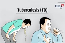 ट्यूबरक्‍यूलोसिस ही नहीं पोस्‍ट टीबी इफैक्‍ट भी हैं बड़ा खतरा, बढ़ रहीं मेंटल-न्‍यूरो की बीमारियां, रिपोर्ट में खुलासा
