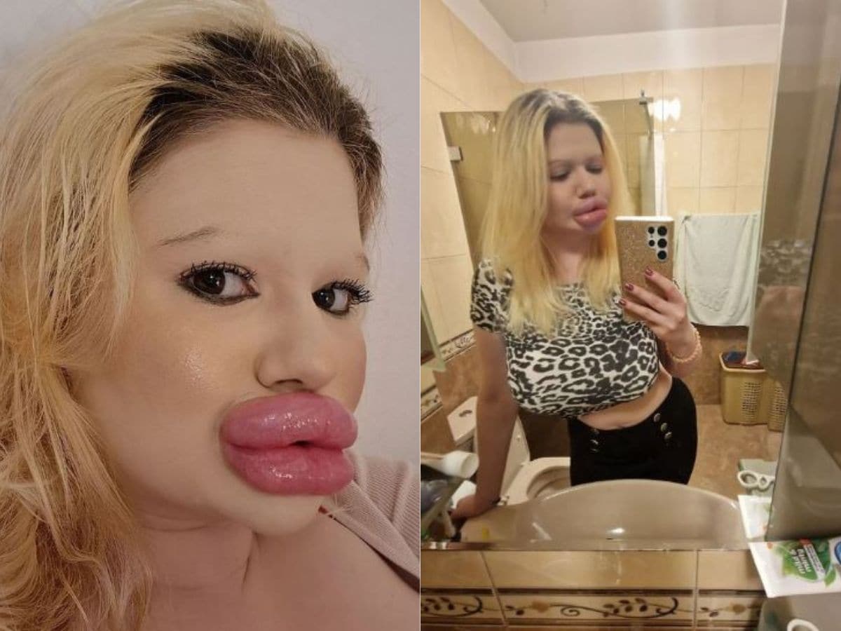 woman with biggest lips 1