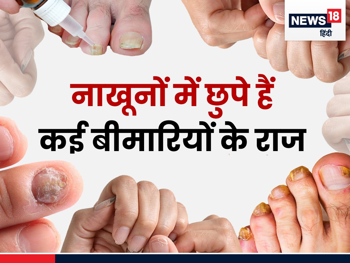 Chote Nakhono Ko Bada Dikhane Ka Tarika,Nail Care: छोटे नाखूनों से परेशान  हैं? इन्हें बड़ा दिखाने के लिए अपनाएं ये आसान तरीके - diy tips to make  short nails look bigger -