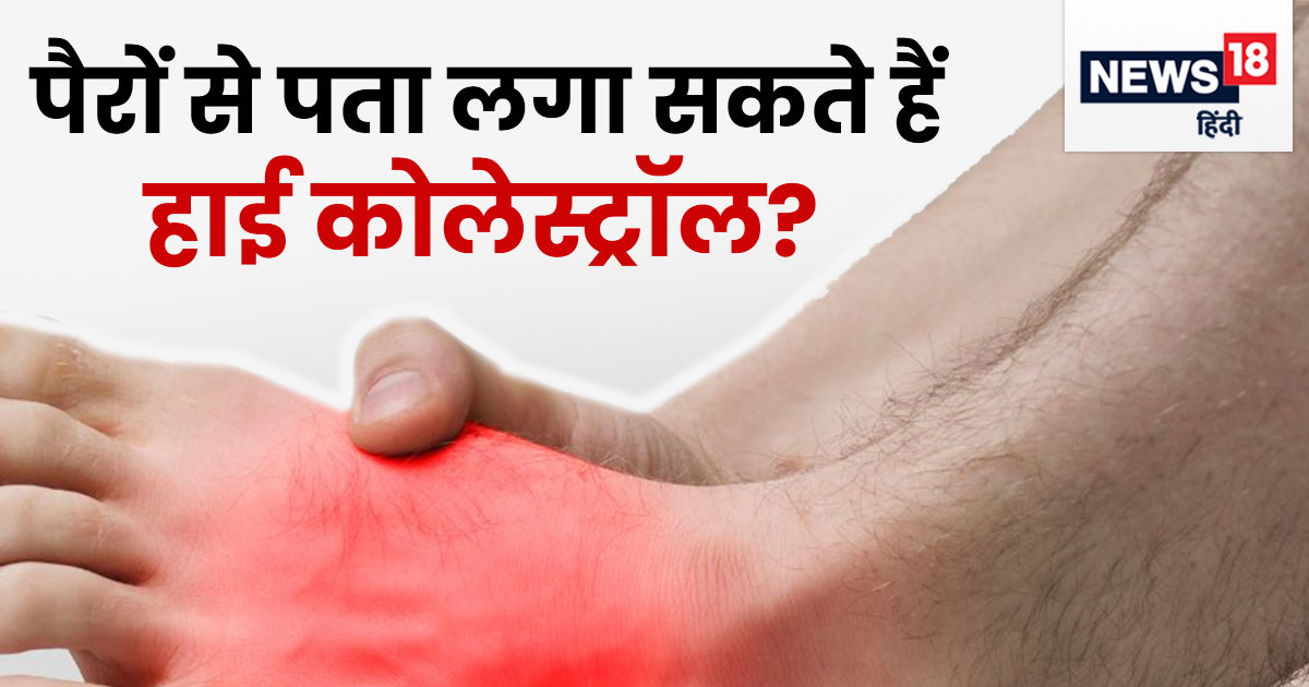 क्या पैरों पर नज़र आने लगते हैं हाई कोलेस्ट्रॉल के लक्षण? आप भी ऐसे