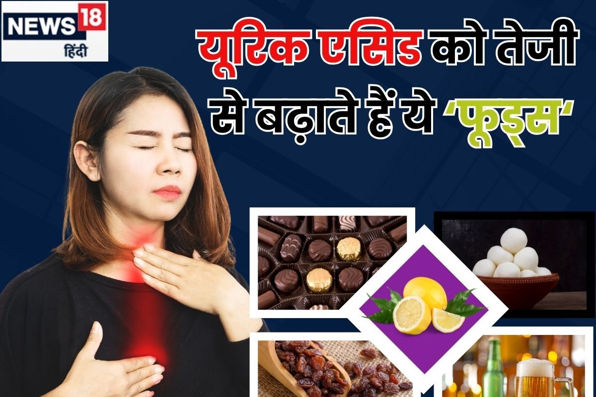 आप में भी दिख रहे हैं यूरिक एसिड के लक्षण? भूलकर भी 5 फूड्स को न लगाएं हाथ
