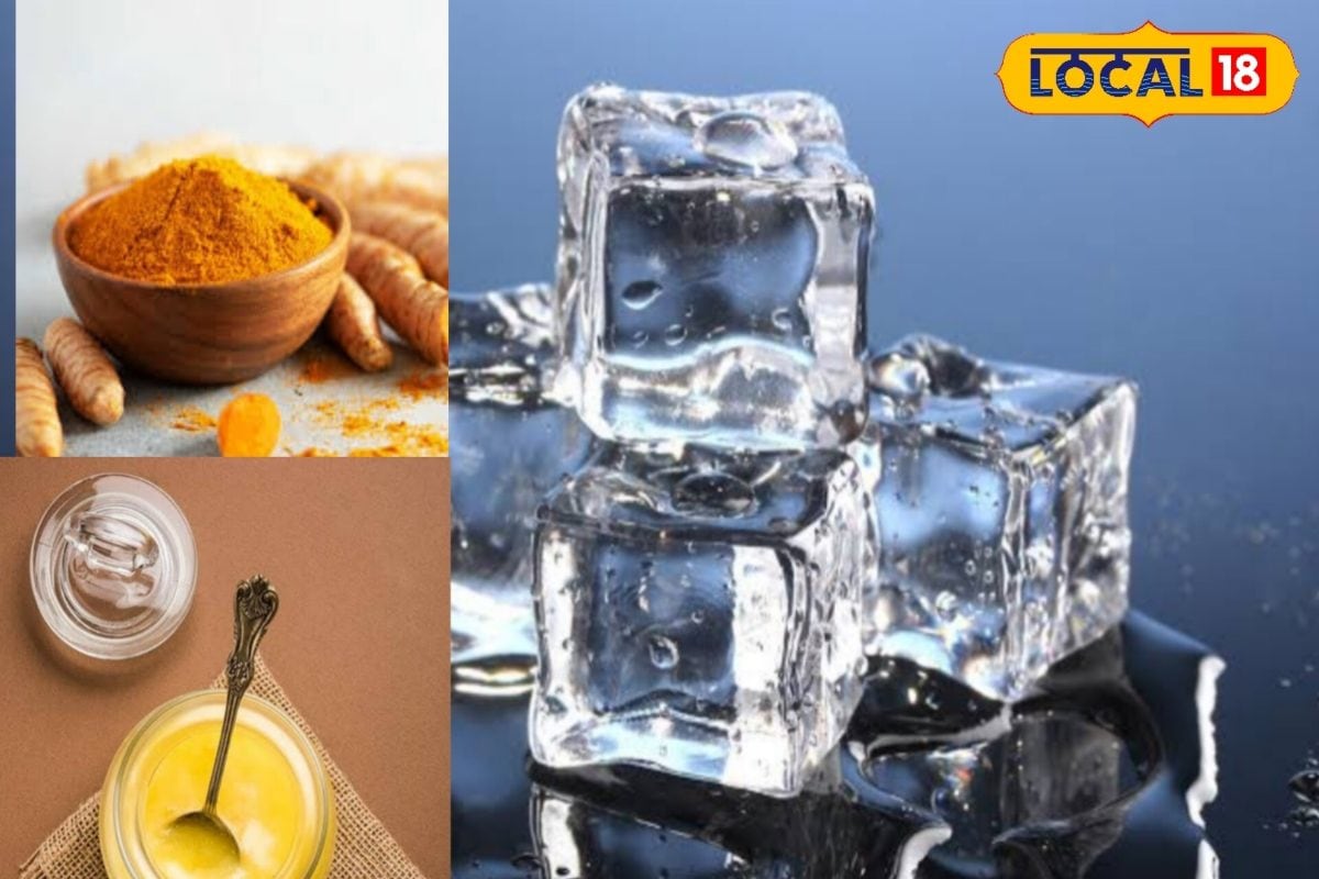 आग या गर्म चीज से जल जानें पर करें ये खास उपाय, आयुर्वेदिक डॉ. से जानें उपाय