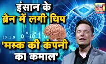 Human Brain Chip Implant: इंसानी दिमाग में लगी चिप ऐसे करेगी काम! | Elon Musk| N18O