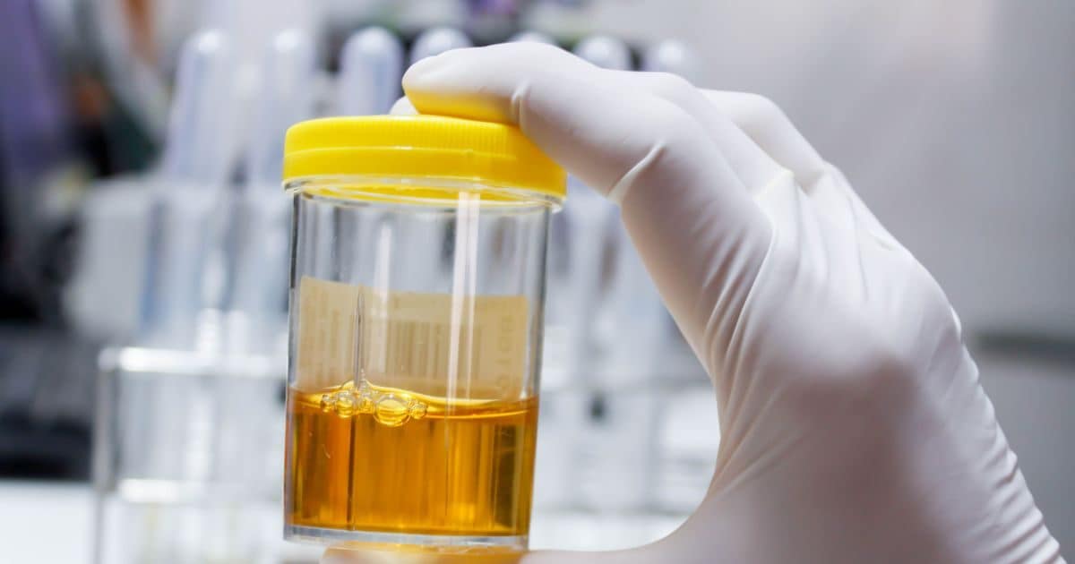What makes urine yellow Researchers have finally figured it out the