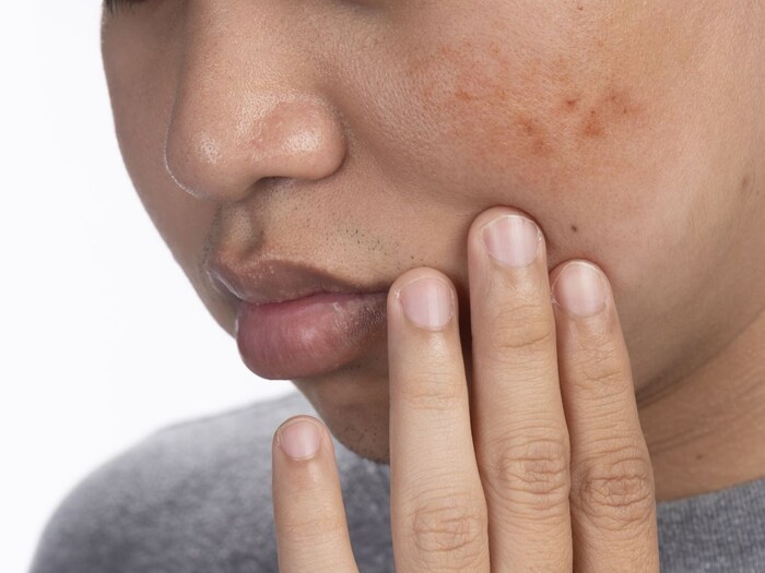 शरीर के साथ बालों को भी डैमेज करता है धुम्रपान, जल्दी आएगा बुढ़ापा 4 Canva