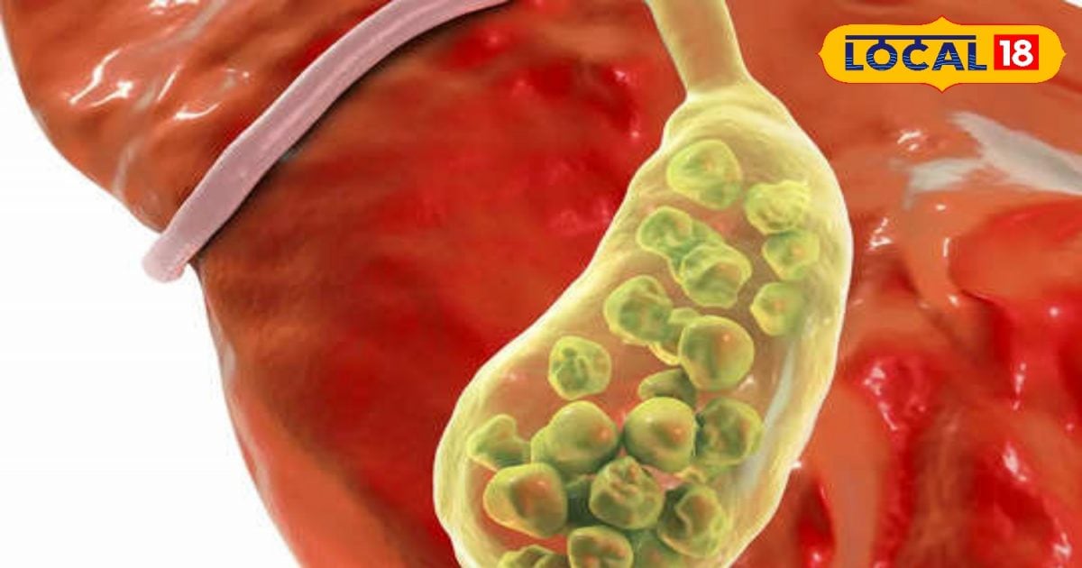 Do not ignore stomach gas even by mistake, it is a sign of this dangerous disease!