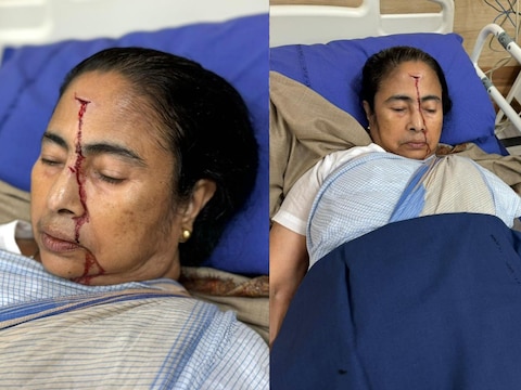 पश्‍च‍िम बंगाल की मुख्‍यमंत्री ममता बनर्जी गंभीर रूप से घायल हो गई थीं.