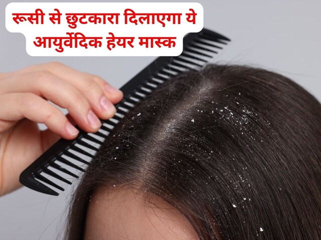 सप्ताह में 2 बार लगाएं ये एंटी-डैंड्रफ हेयर मास्क, बालों का झड़ना भी होगा बंद