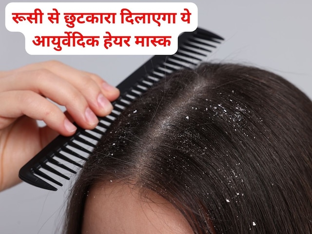 सप्ताह में 2 बार लगाएं ये एंटी-डैंड्रफ हेयर मास्क, बालों का झड़ना भी होगा बंद सप्ताह में 2 बार लगाएं ये एंटी-डैंड्रफ हेयर मास्क, बालों का झड़ना भी होगा बंद