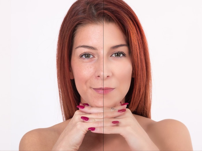 एंटी-एजिंग की तरह काम करते है यह फूड्स, अपनी स्किन के लिए एकबार जरुर करें इस्तेमाल 1 news18 hindi