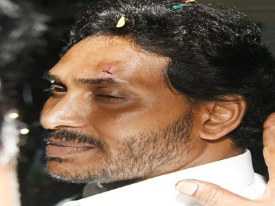 आंध्र प्रदेश के CM जगन मोहन रेड्डी को काफिले पर हुए पथराव में चोट लगी है. (Image:News18)