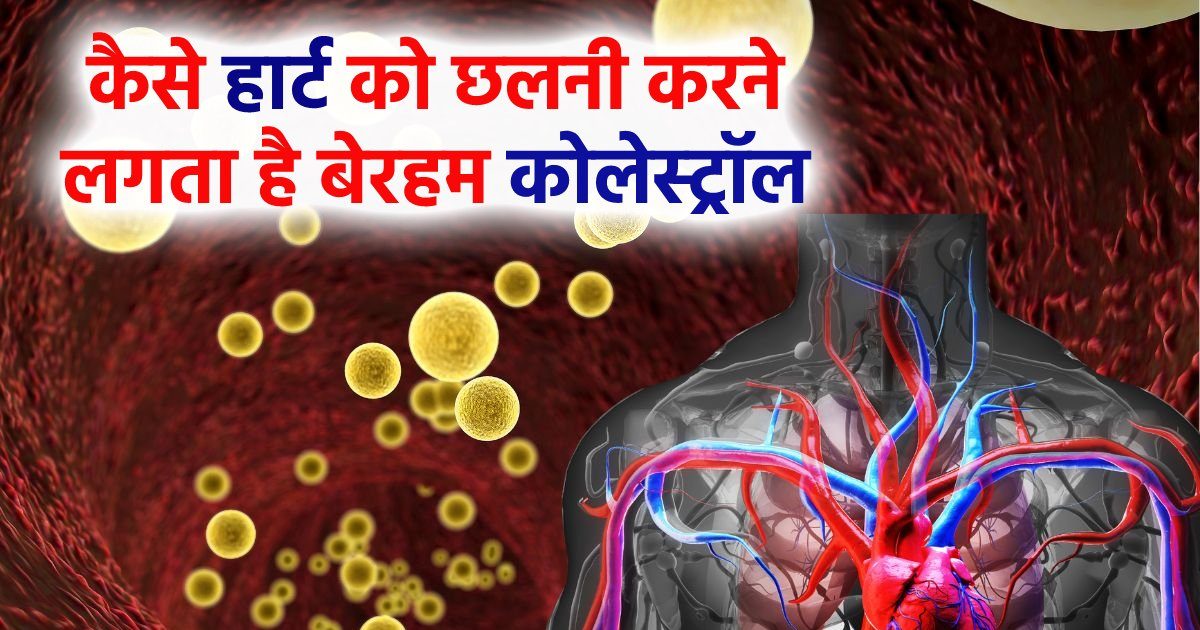 धमनियों में क्यों चिपक जाता है बेरहम कोलेस्ट्रॉल, कब हार्ट पर आने लगती है आंच, कैसे निकले इस झंझट से, जानें सब कुछ