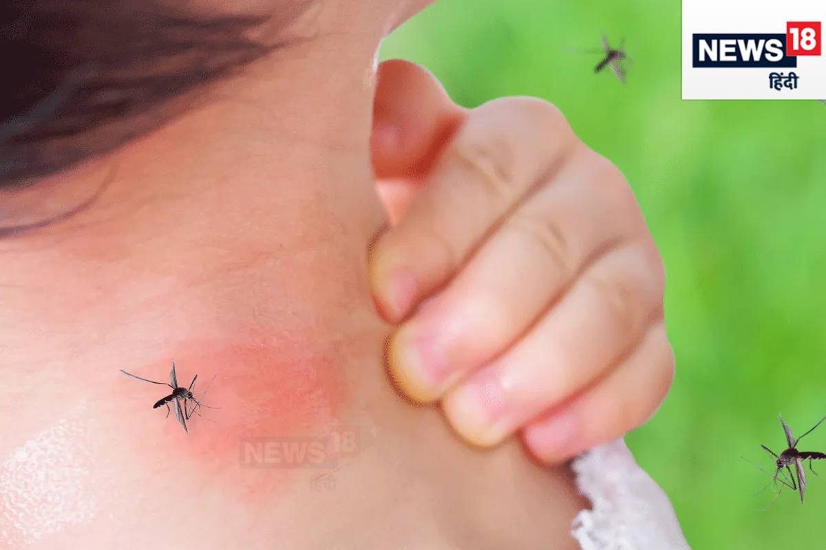 लड़कियों से ज्‍यादा लड़कों को काटता है डेंगू का मच्‍छर! इस उम्र में खतरा