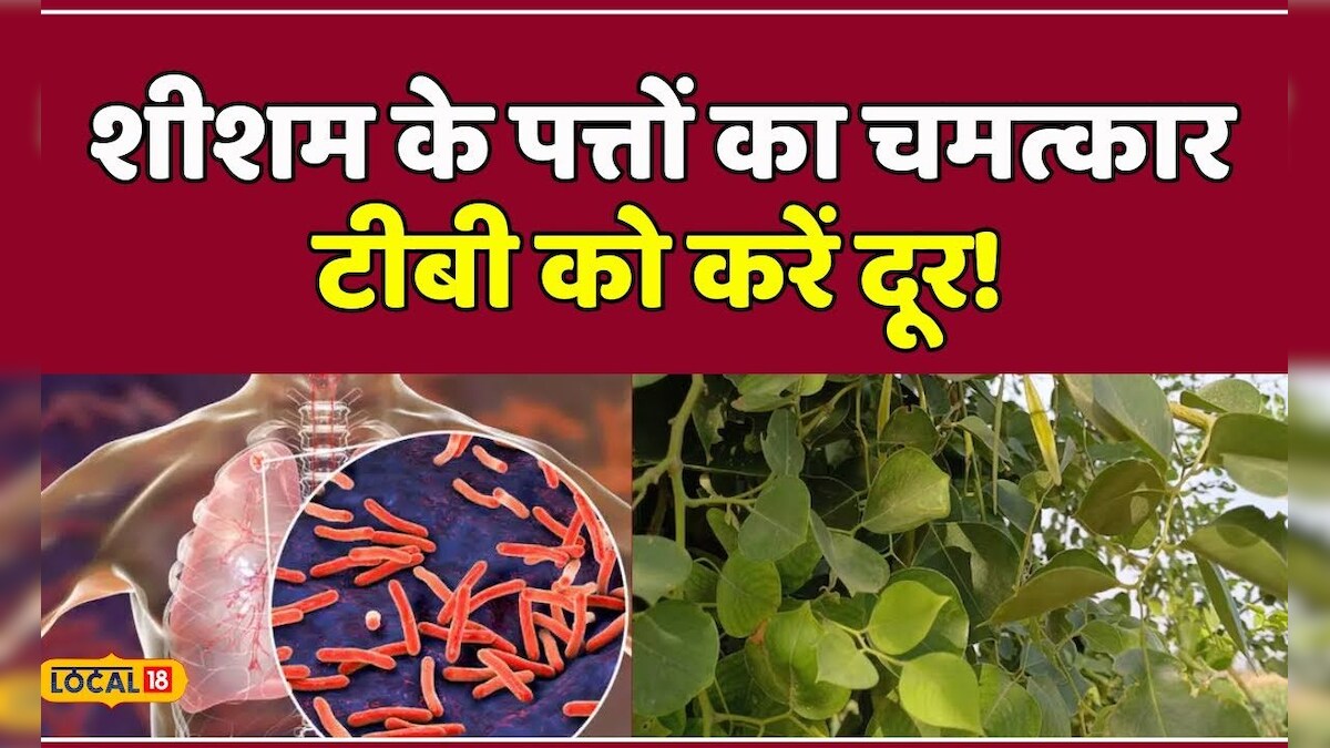 Health Tips: TB का प्राकृतिक इलाज, शीशम के पत्तों से अद्भुत लाभ | # ...