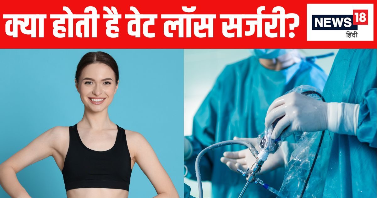मोटापा कम करने में दवाओं से ज्यादा कारगर है वेट लॉस सर्जरी ! स्टडी में हुआ खुलासा