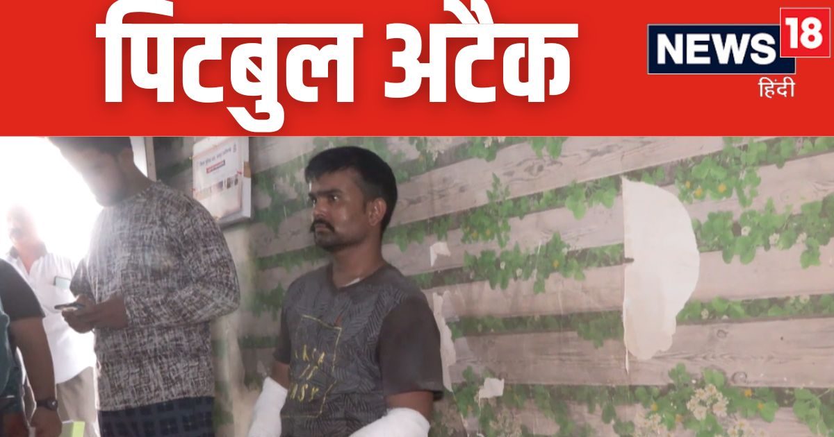 रायपुर में पिटबुल डॉग का हमला, बचाओ-बचाओ चिल्लाता रहा दोषी लड़का