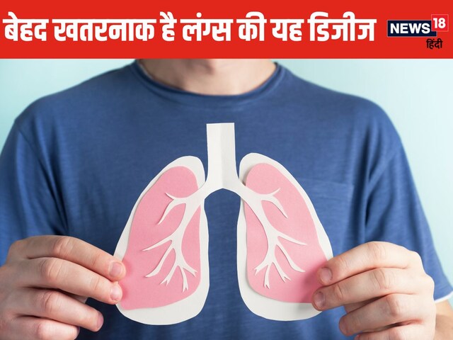 भारत में इस घातक बीमारी के सबसे ज्यादा मरीज ! फेफड़ों पर करती है सीधा अटैक