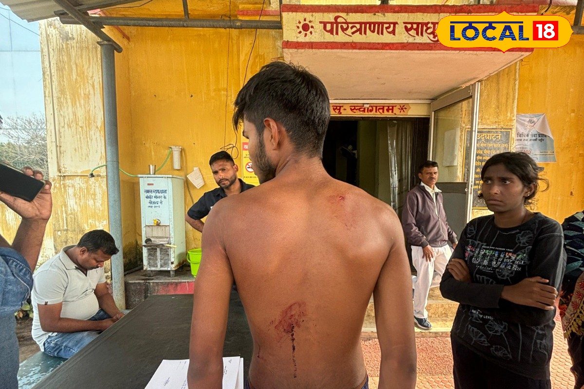 शिक्षा के मंदिर में चाकू बाजी, स्कूली युवकों ने किया चाकू से किया वार