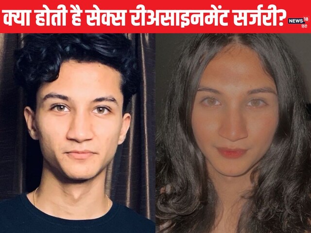 क्या जेंडर बदलना मानसिक बीमारी है? क्‍यों कहलाते हैं ये ट्रांसमैन-ट्रांसवुमन
