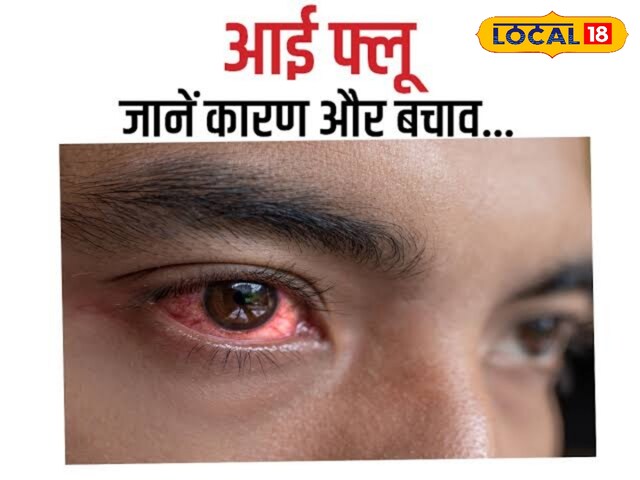 तेजी से फैल रही है आंखों की यह बीमारी, ऐसे लक्षण दिखने पर तुरंत कराएं इलाज