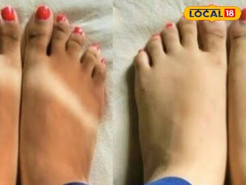 suntan suntan