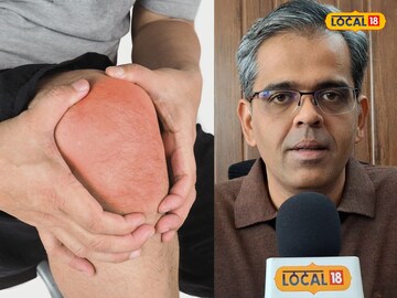 स्नैपिंग स्नैपिंग