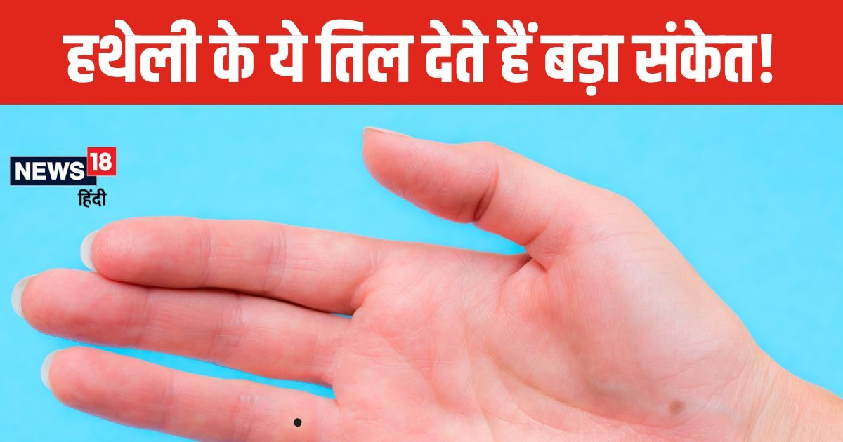 दूसरों की मदद के लिए तैयार रहते हैं अंगूठे पर तिल वाले जातक, जानें हथेली के अलग-अलग हिस्सों में तिल होने का अर्थ