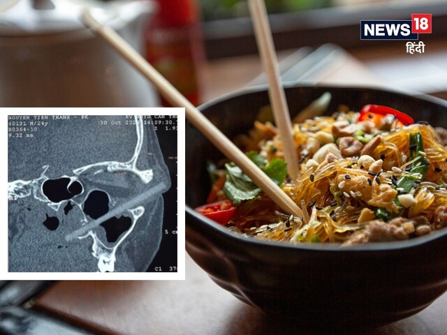 आंख में थी सूजन और दर्द, डॉक्टरों को स्कैन में दिखा कुछ ऐसा, उड़ गए होश!