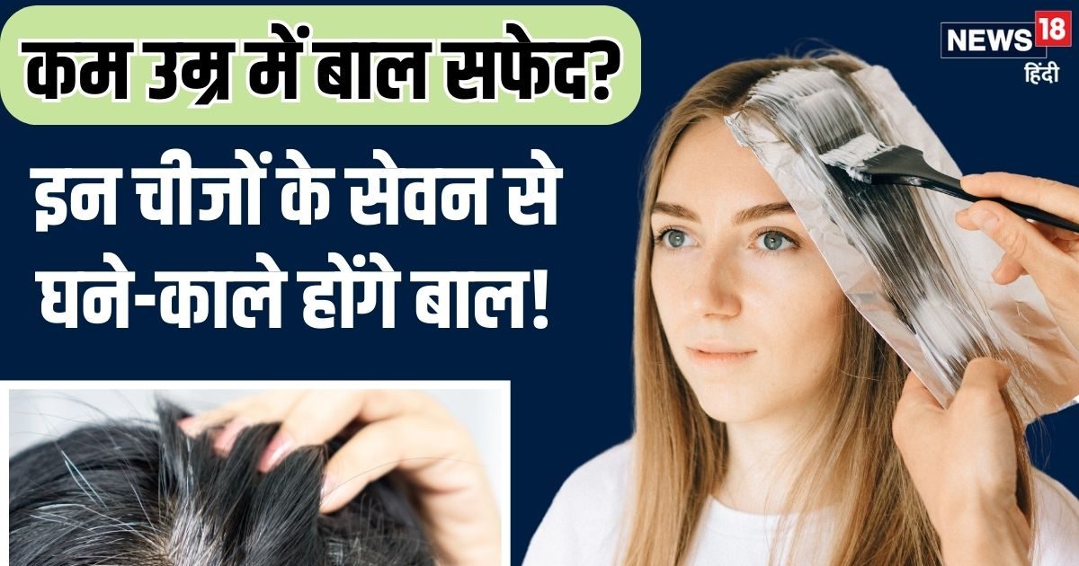 कम उम्र में बाल सफेद क्यों होने लगते हैं? ये 4 विटामिंस भी हो सकते जिम्मेदार, इन हेल्दी फूड से करें भरपाई