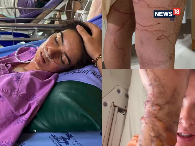 मोबाइल सी 'वाइब्रेट' हुई बॉडी, ऐसा है धरती के सबसे जहरीले जीव का डंक!