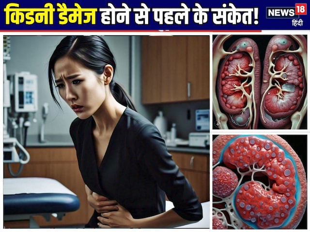 Kidney does not deteriorate like this ... Body gives 5 big signs before damage Kidney does not deteriorate like this ... Body gives 5 big signs before damage