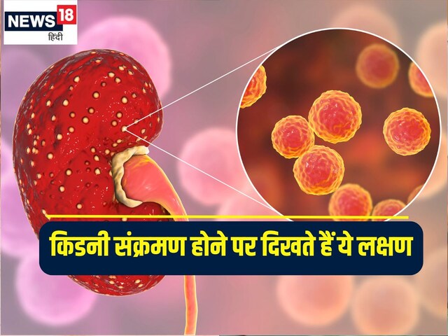 किडनी इंफेक्शन होने से पहले दिखते हैं ये लक्षण, मूत्र का ये रोग होता है कारण