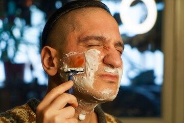 Cheek cut while shaving, angry man files case against razor company! Cheek cut while shaving, angry man files case against razor company!