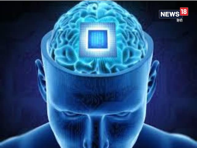 Large success: Nuuralink fits the third chip of human mind Large success: Nuuralink fits the third chip of human mind