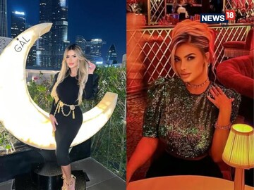 सुंदरता के लिए महिला ने उड़ाए करोड़ों, ताबड़तोड़ कराई सर्जरी!