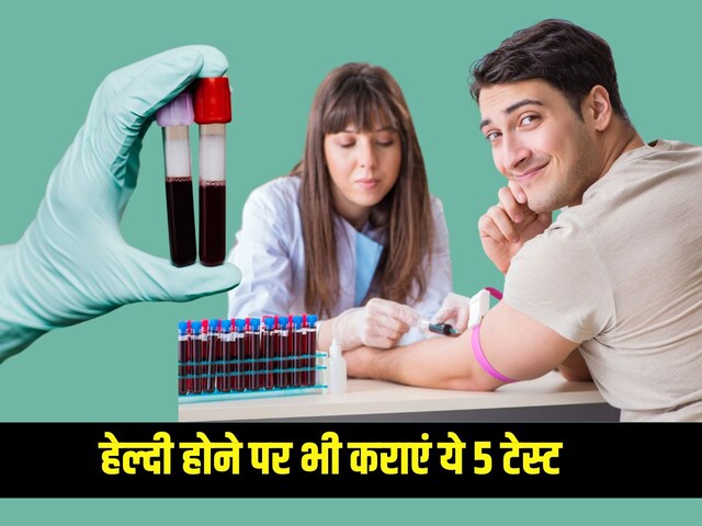 बेशक आप हेल्दी हैं लेकिन 25 के बाद हर मर्द को हर साल कराने चाहिए ये 5 टेस्ट