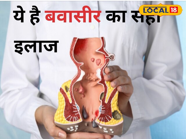 ना चीरा ना टांका, हकीम के बताए घरेलू नुस्खे दूर होगी बवासीर की समस्या