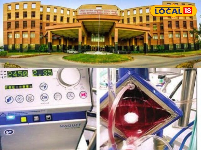 13 दिन तक वेंटिलेटर पर रही 6 साल की बच्ची, आखिर मिला नया जीवन